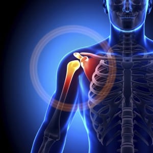 Osteoarthritis of the Shoulder | STAR Physical Therapy | Tennessee | TN