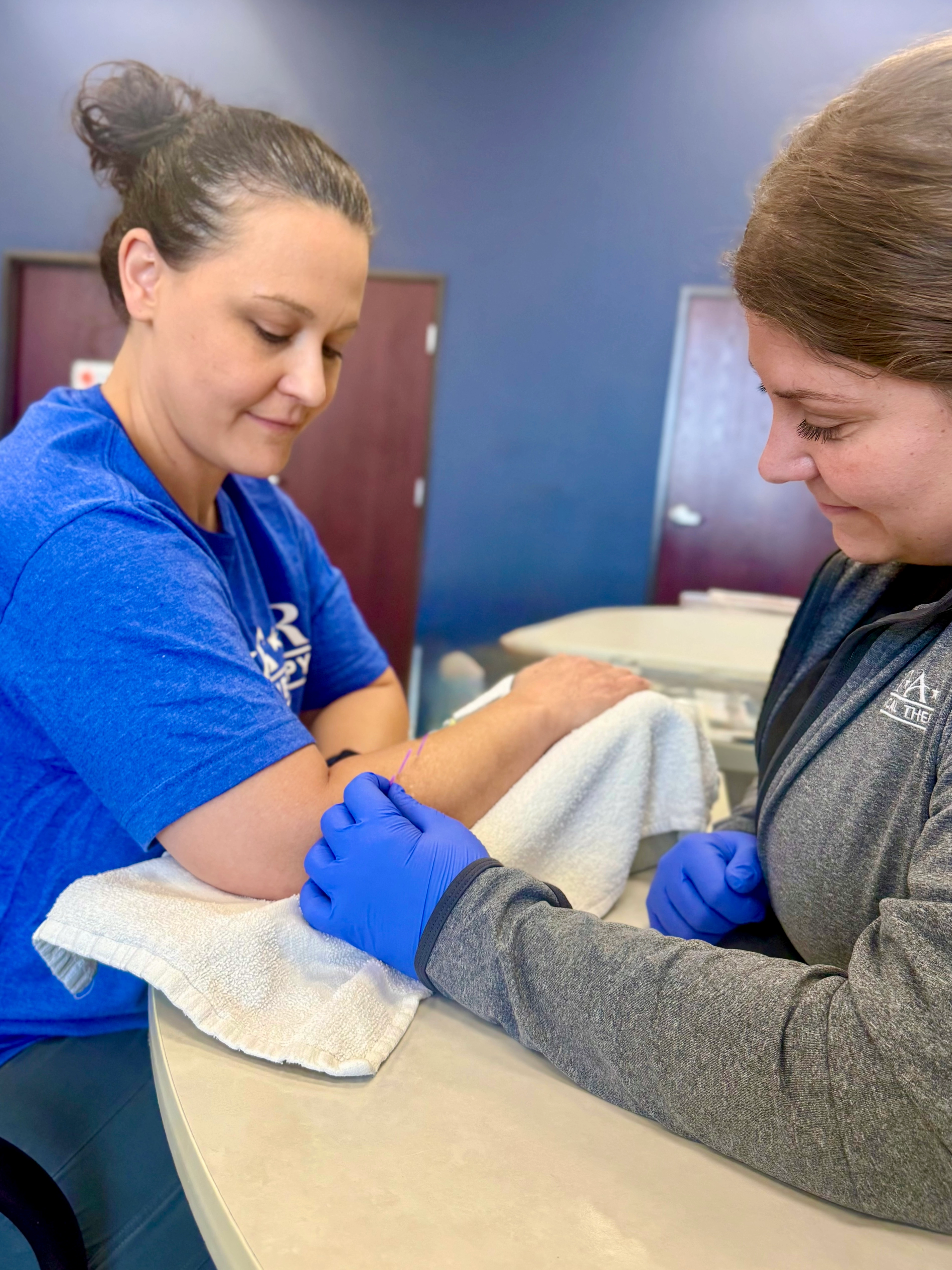 Elbow Pain Dry Needling